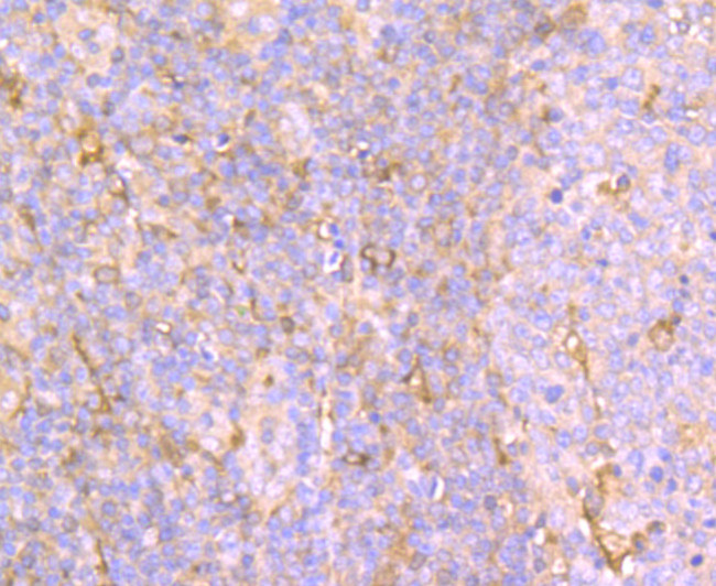 AFP Antibody in Immunohistochemistry (Paraffin) (IHC (P))