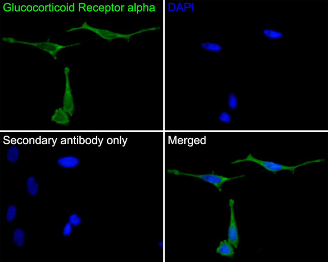 Glucocorticoid Receptor alpha Antibody in Immunocytochemistry (ICC/IF)