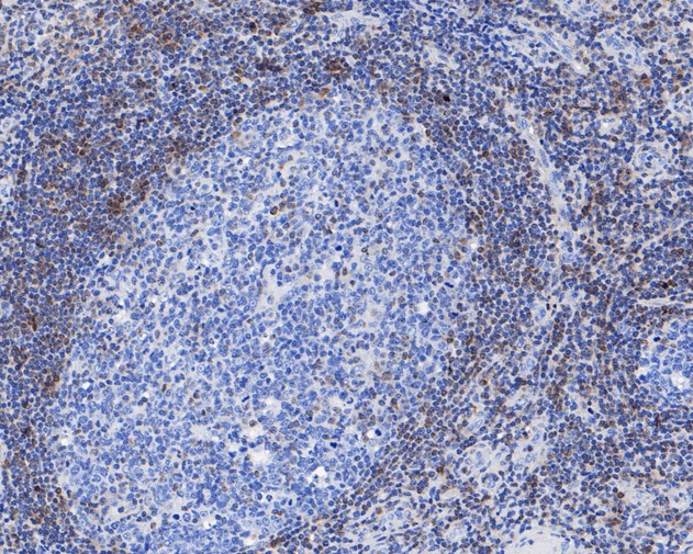 Bcl-2 Antibody in Immunohistochemistry (Paraffin) (IHC (P))