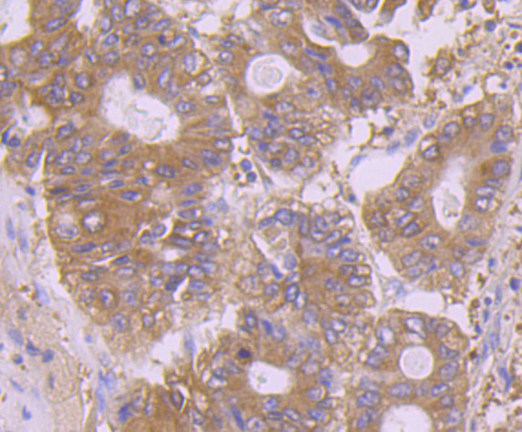 Calpain 1 Antibody in Immunohistochemistry (Paraffin) (IHC (P))