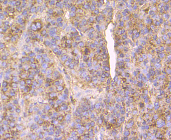 Cathepsin D Antibody in Immunohistochemistry (Paraffin) (IHC (P))