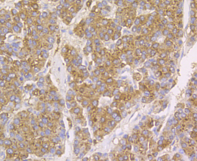 Cathepsin D Antibody in Immunohistochemistry (Paraffin) (IHC (P))