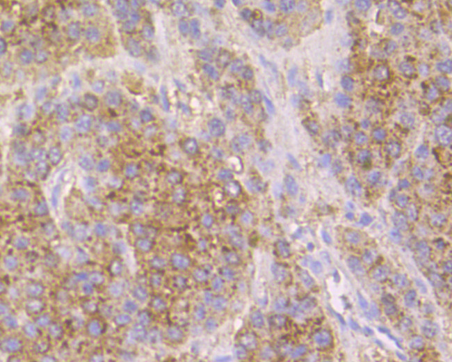 Cathepsin D Antibody in Immunohistochemistry (Paraffin) (IHC (P))