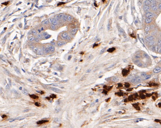 Myeloperoxidase Antibody in Immunohistochemistry (Paraffin) (IHC (P))