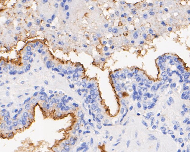 CD10 Antibody in Immunohistochemistry (Paraffin) (IHC (P))