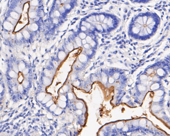CD10 Antibody in Immunohistochemistry (Paraffin) (IHC (P))