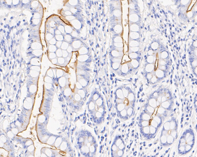 CD10 Antibody in Immunohistochemistry (Paraffin) (IHC (P))