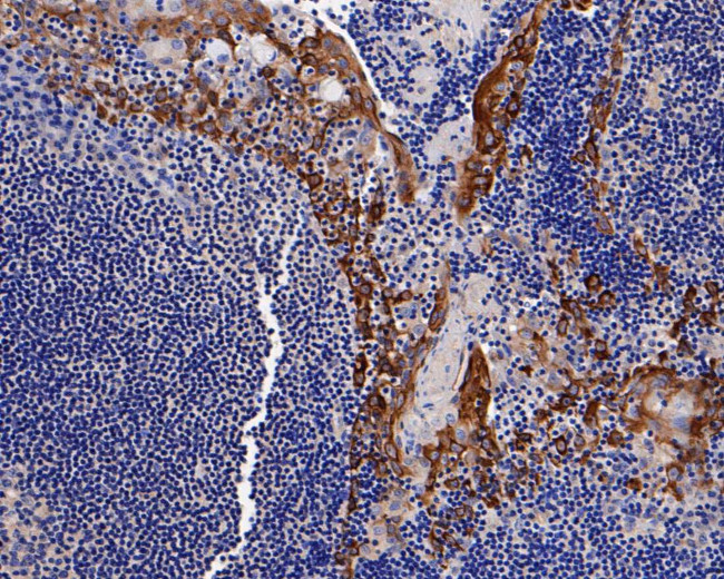 Cytokeratin 14 Antibody in Immunohistochemistry (Paraffin) (IHC (P))