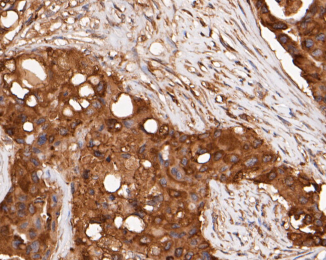 ERK2 Antibody in Immunohistochemistry (Paraffin) (IHC (P))