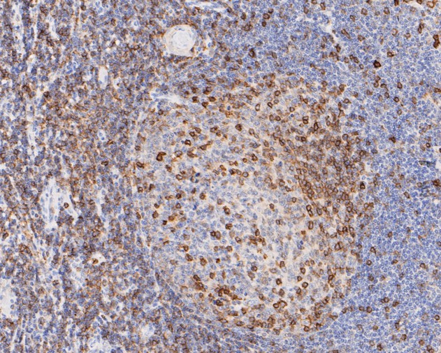 CD43 Antibody in Immunohistochemistry (Paraffin) (IHC (P))