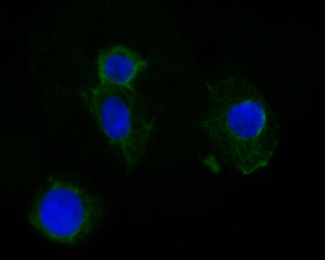 Cytokeratin 19 Antibody in Immunocytochemistry (ICC/IF)