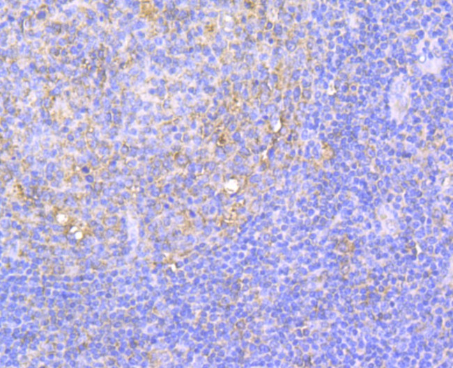 Integrin beta 1 Antibody in Immunohistochemistry (Paraffin) (IHC (P))