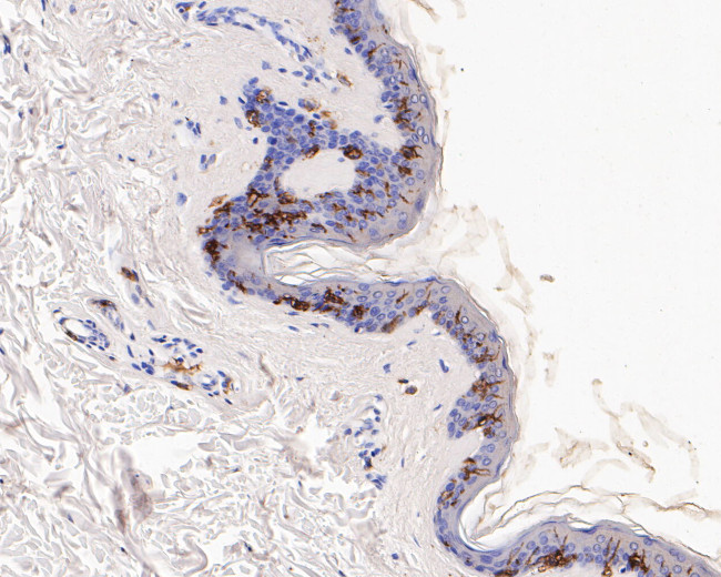 CD1A Antibody in Immunohistochemistry (Paraffin) (IHC (P))
