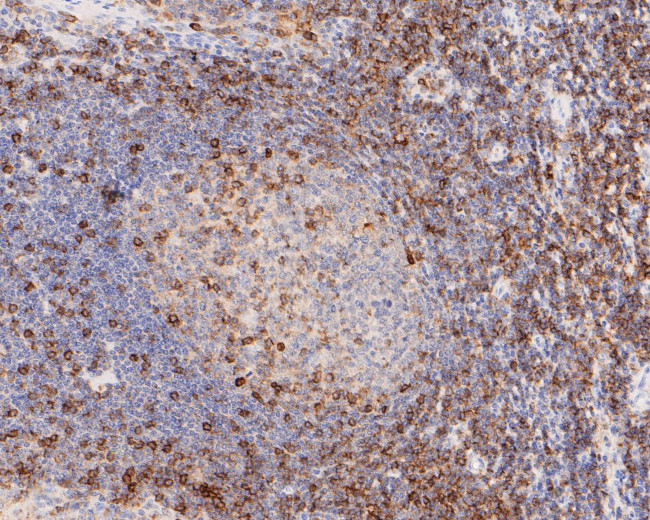 CD43 Antibody in Immunohistochemistry (Paraffin) (IHC (P))