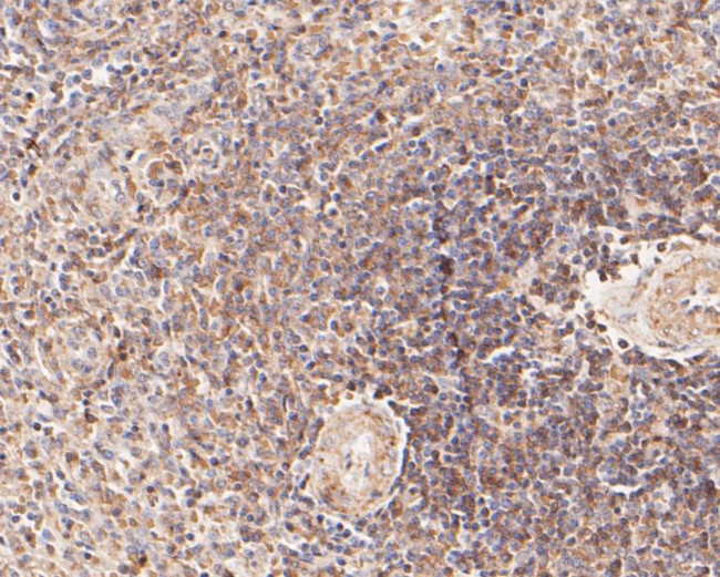 CD22 Antibody in Immunohistochemistry (Paraffin) (IHC (P))