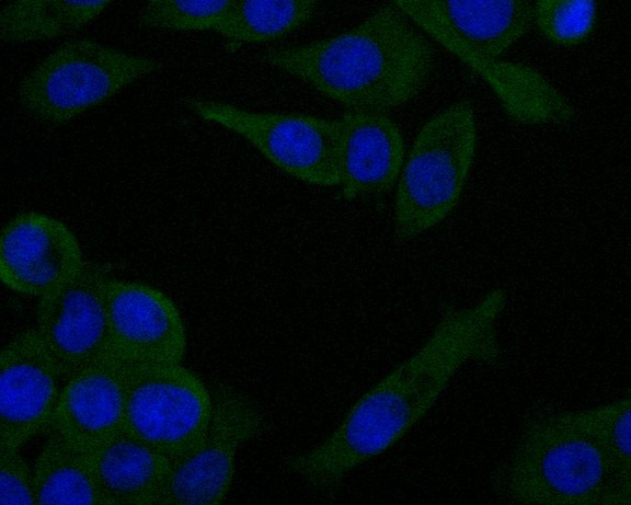 ZAP70 Antibody in Immunocytochemistry (ICC/IF)