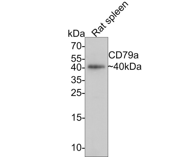 CD79a Antibody in Western Blot (WB)