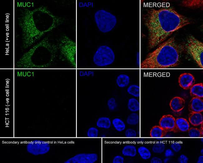 MUC1 Antibody in Immunocytochemistry (ICC/IF)