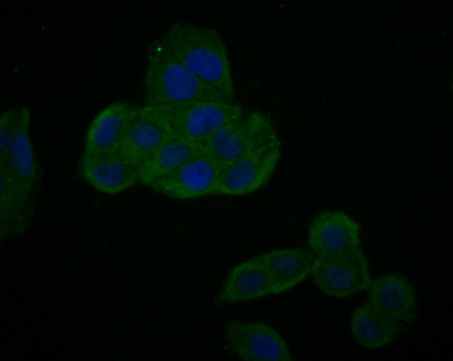 Myc Tag Antibody in Immunocytochemistry (ICC/IF)