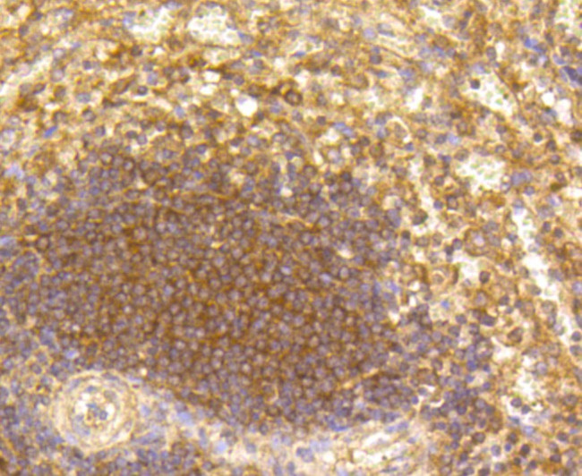 CD19 Antibody in Immunohistochemistry (Paraffin) (IHC (P))
