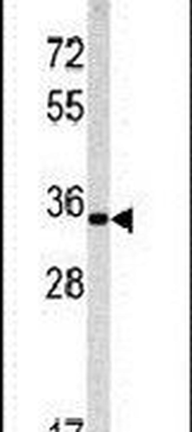 Emerin Antibody in Western Blot (WB)