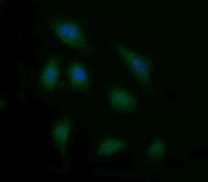 ENG Antibody in Immunocytochemistry (ICC/IF)