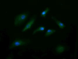 ENG Antibody in Immunocytochemistry (ICC/IF)