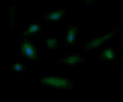 ENG Antibody in Immunocytochemistry (ICC/IF)