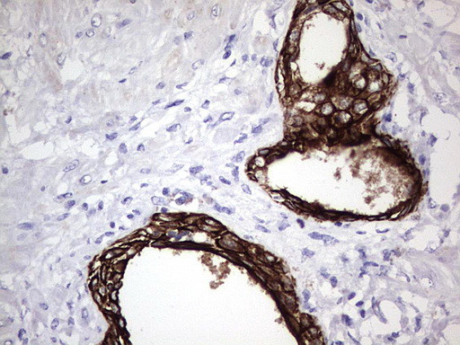 ENKUR Antibody in Immunohistochemistry (Paraffin) (IHC (P))