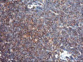 ENPEP Antibody in Immunohistochemistry (Paraffin) (IHC (P))