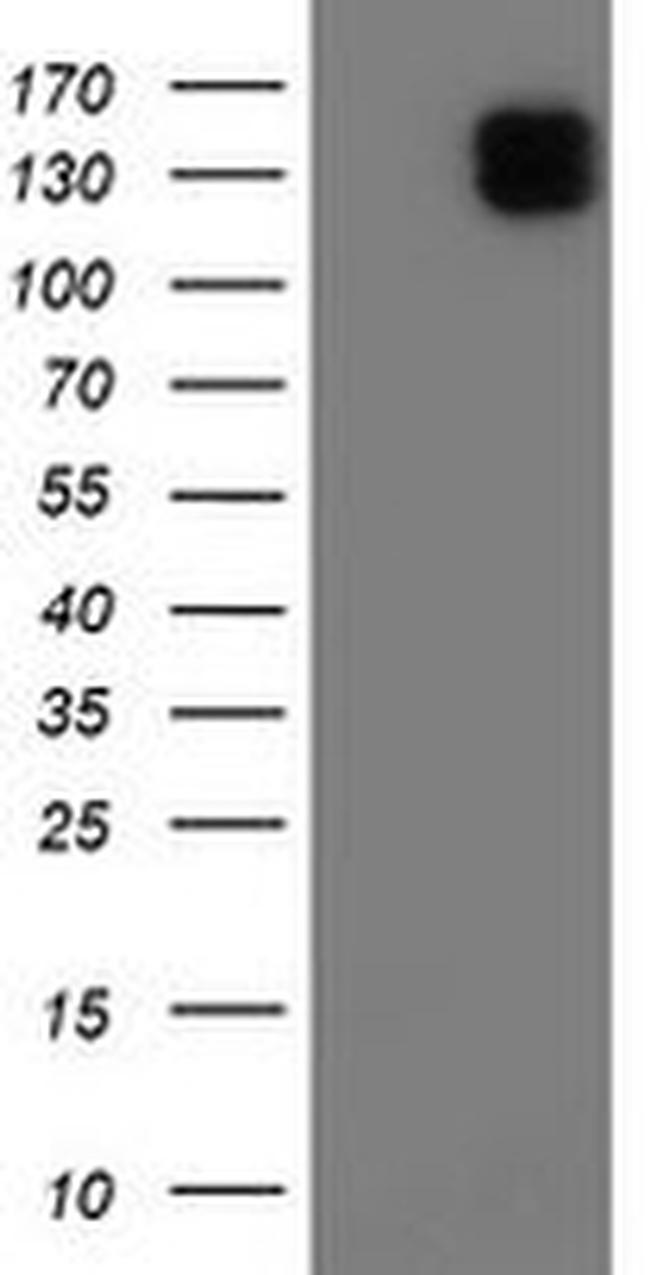 ENPEP Antibody in Western Blot (WB)