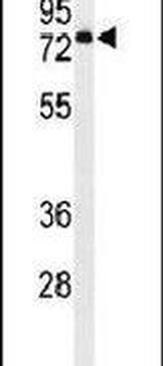 ENPP7 Antibody in Western Blot (WB)