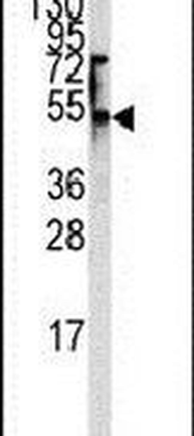 ENT1 Antibody in Western Blot (WB)