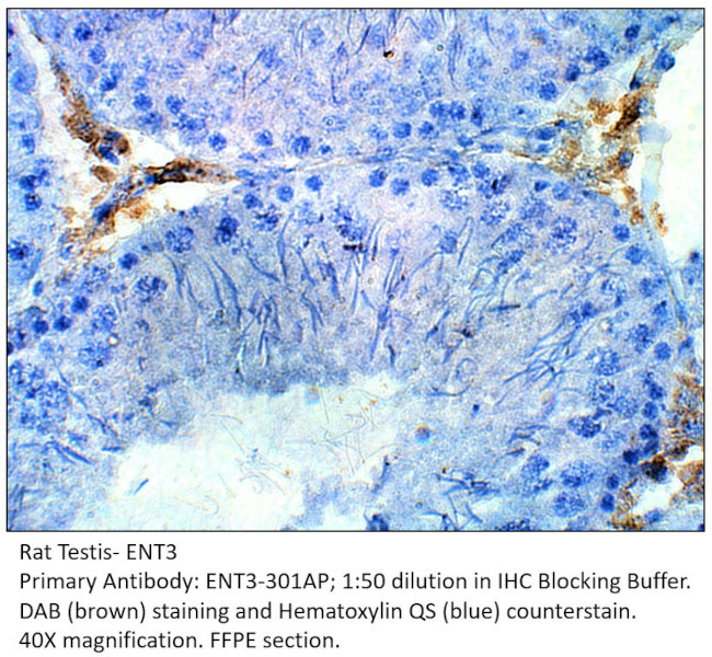 SLC29A3 Antibody in Immunohistochemistry (IHC)