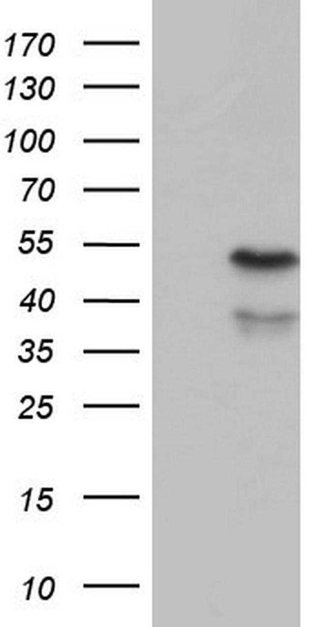 ENTPD1 Antibody in Western Blot (WB)