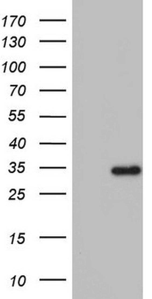 ENTPD1 Antibody in Western Blot (WB)