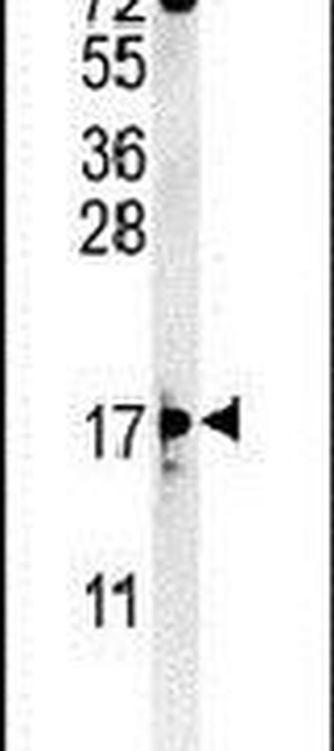 ENY2 Antibody in Western Blot (WB)