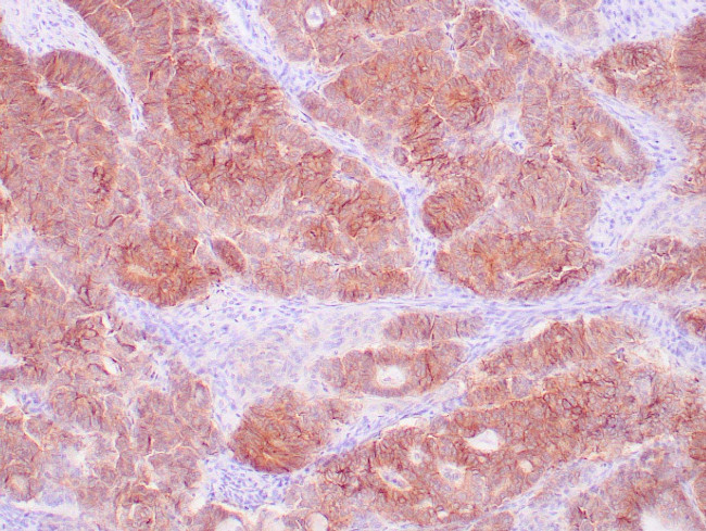 EP-CAM / ESA Antibody in Immunohistochemistry (Paraffin) (IHC (P))