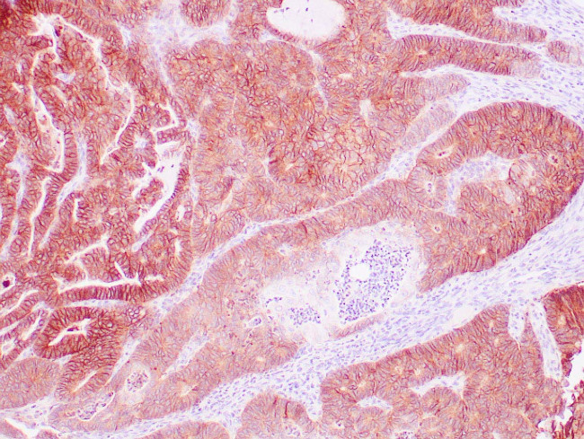 EP-CAM / ESA Antibody in Immunohistochemistry (Paraffin) (IHC (P))