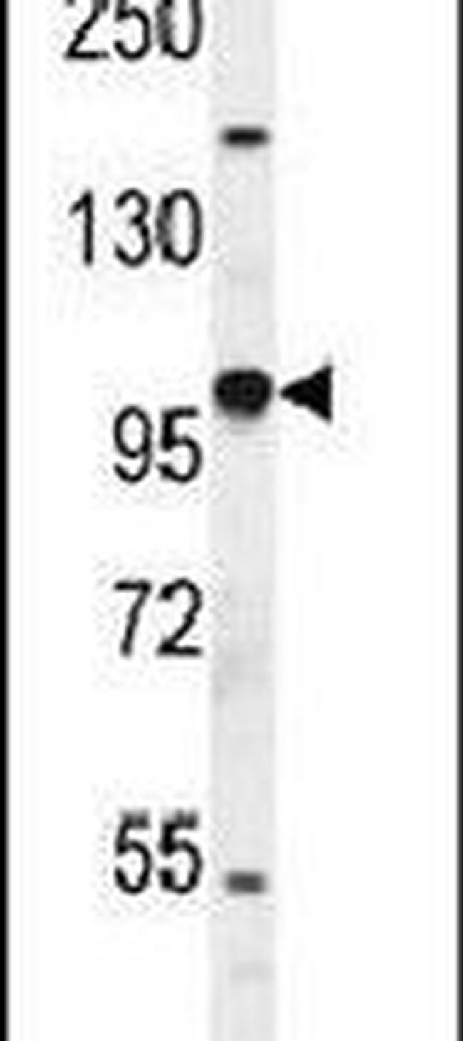 HIF-2 alpha Antibody in Western Blot (WB)
