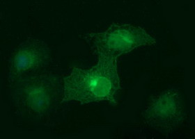 EPCAM Antibody in Immunocytochemistry (ICC/IF)