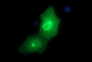 EPCAM Antibody in Immunocytochemistry (ICC/IF)