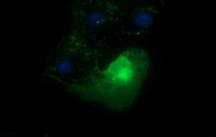 EPCAM Antibody in Immunocytochemistry (ICC/IF)