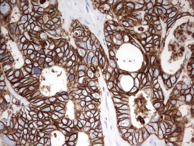 EPCAM Antibody in Immunohistochemistry (Paraffin) (IHC (P))