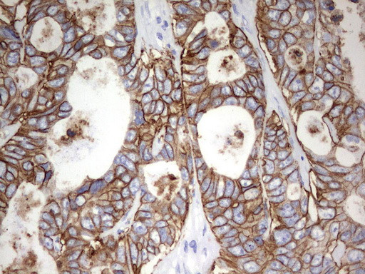 EPCAM Antibody in Immunohistochemistry (Paraffin) (IHC (P))