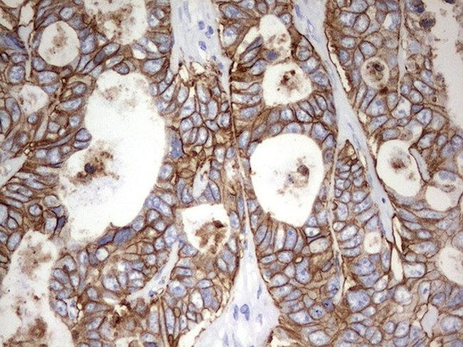 EPCAM Antibody in Immunohistochemistry (Paraffin) (IHC (P))