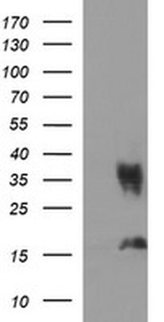 EPCAM Antibody in Western Blot (WB)