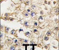 EphA10 Antibody in Immunohistochemistry (IHC)