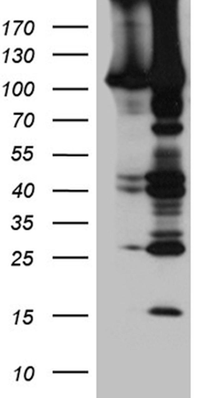 EPHA4 Antibody in Western Blot (WB)