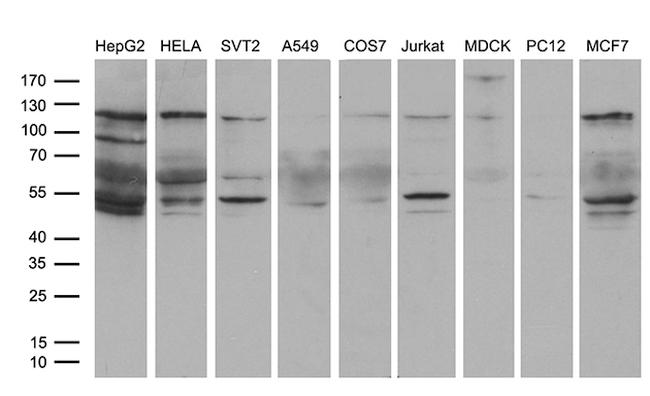 EPHA6 Antibody in Western Blot (WB)